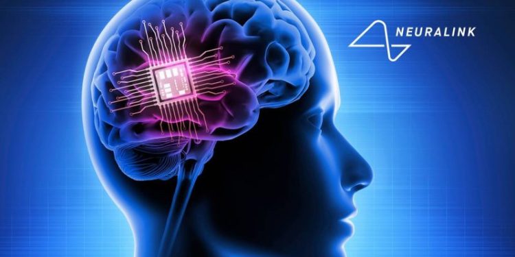 Can You Invest in Neuralink?